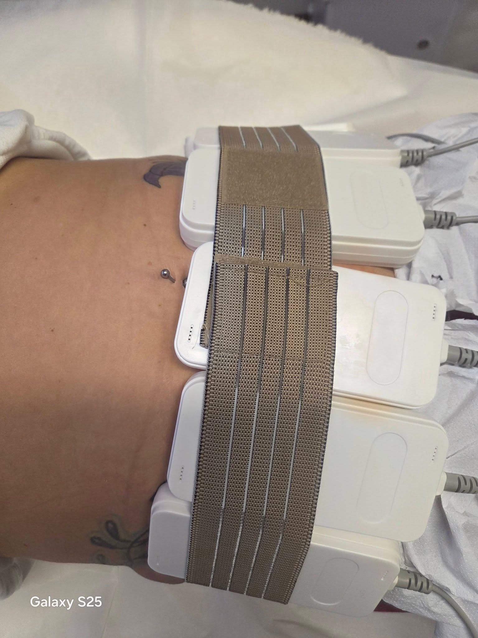 Tummy Sculpting Process